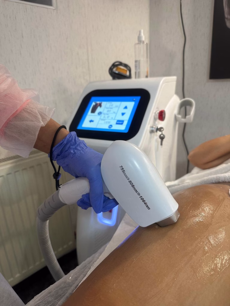 Epilare Definitva Laser 3 epilare definitva 5
