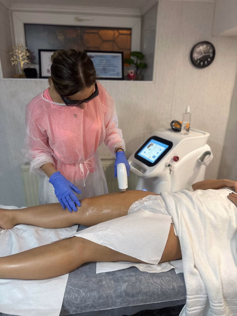 Epilare Definitva Laser 1 epilare definitva 6